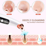 Blackhead Remover Pore Vacuum - Jemyda Rechargeable Black Heads Removal Tool with 6 Sucking Probes